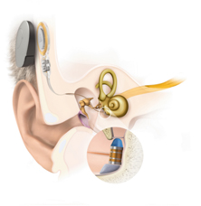 Anatomie Vibrant Soundbridge