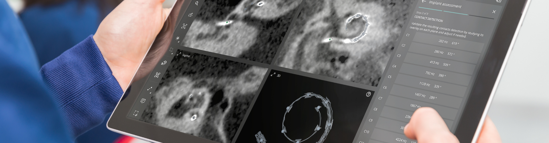 Place-Based Mapping With Anatomy-Based Fitting A tablet displays a screen in the OTOPLAN software, which allows clinicians to view the exact angular insertion depth of each electrode contact along with the corresponding tonotopic frequency location to be used for anatomy-based fitting.