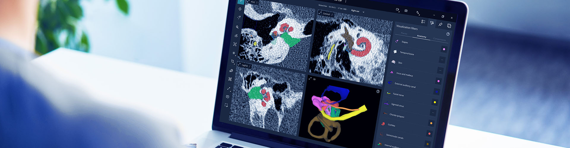 OTOPLAN Software