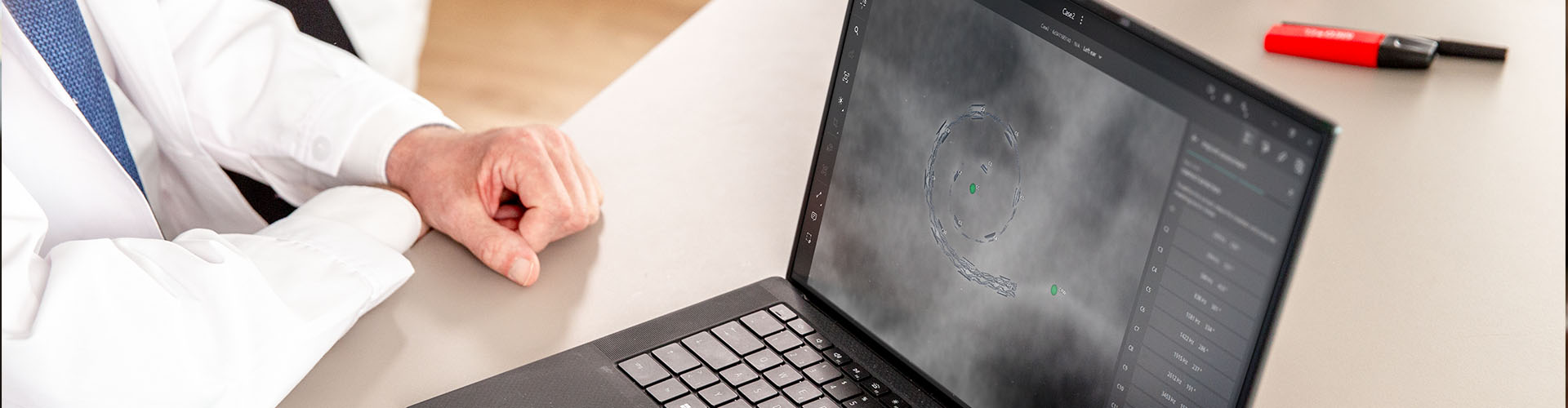 OTOPLAN Software