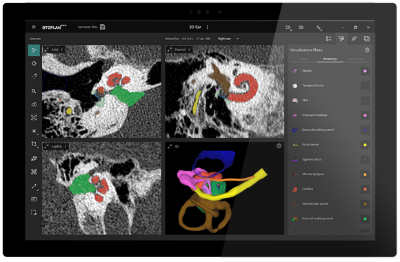OTOPLAN Software
