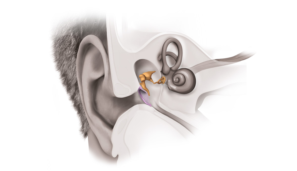 Optimal Sound Conduction how-hearing-works-step2