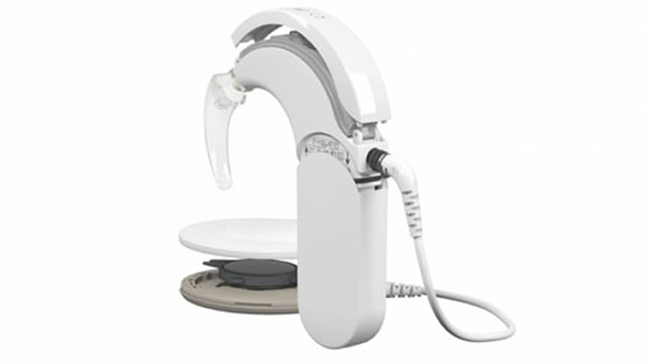 Modular SONNET 2 Processor Design