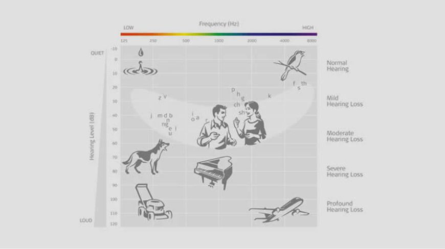 audiogram