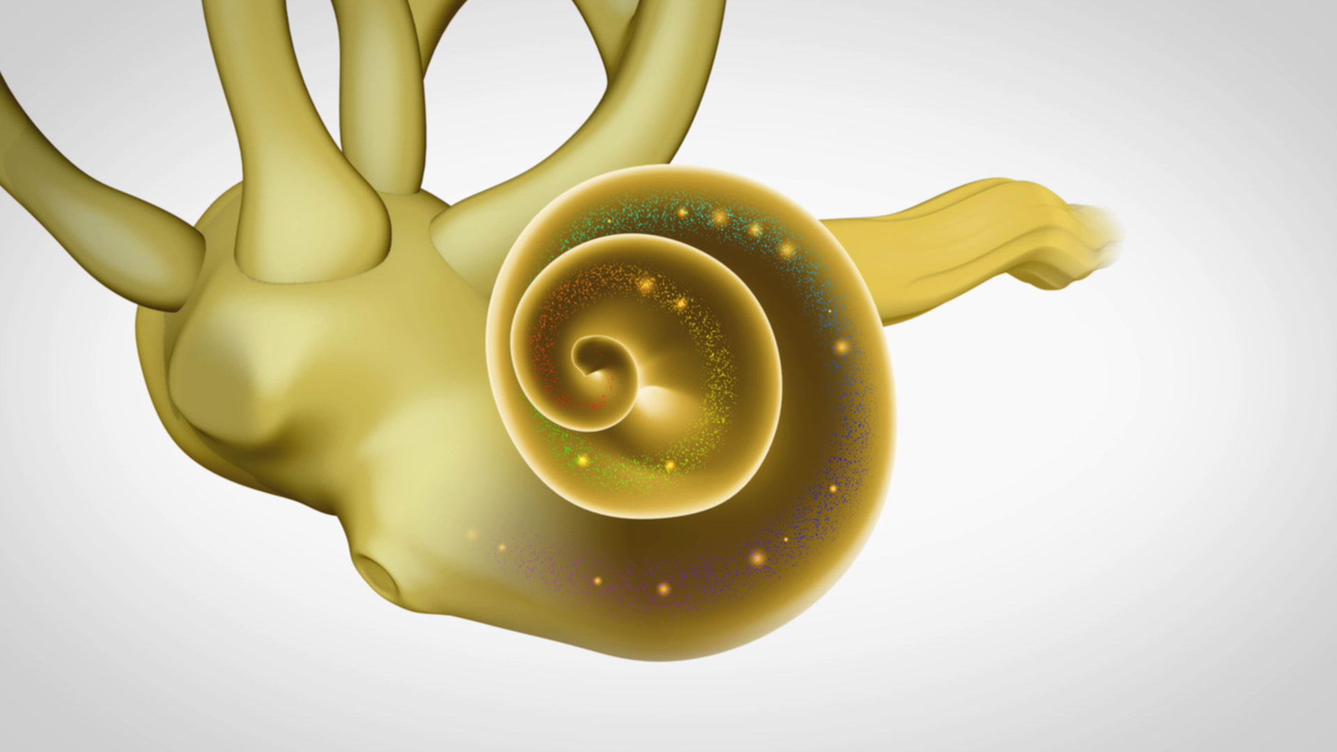 sensorineural-hearing-loss