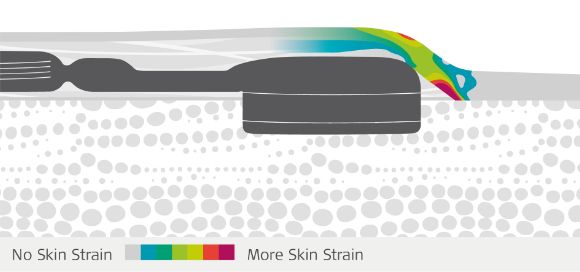Low Profile Reduces Skin Strain