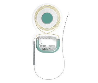 synchrony_implant_comparison
