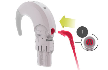 SONNET 2 Plug in Coil Cable