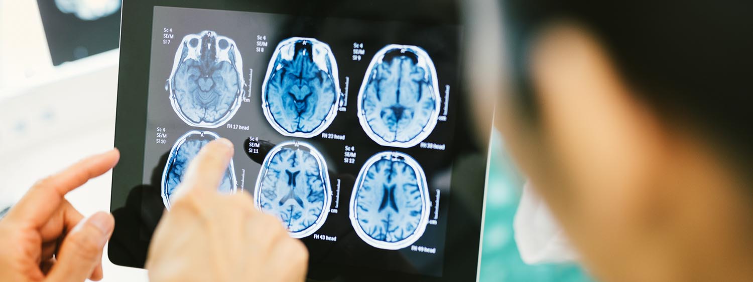 Diagnose der infantilen Zerebralparese Diagnose der infantilen Zerebralparese