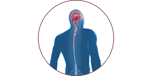FES bei Multipler Sklerose | STIWELL® Neurorehabilitation