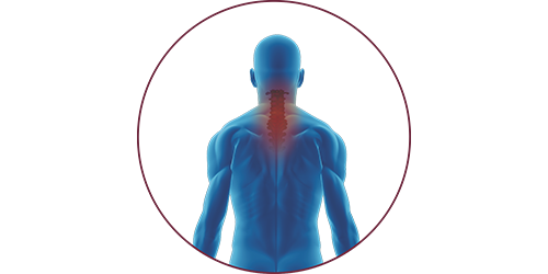 FES bei Tetraplegie | STIWELL® Neurorehabilitation