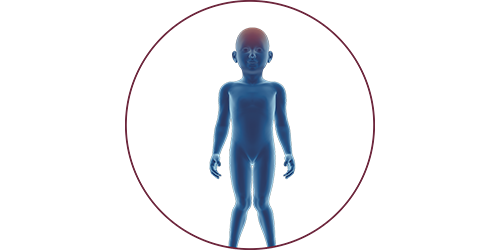 FES for cerebral palsy | STIWELL® Neurorehabilitation