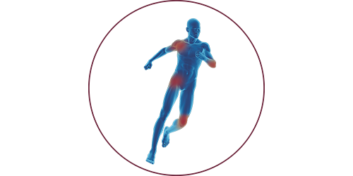 FES for orthopaedics & traumatology | STIWELL® Neurorehabilitation