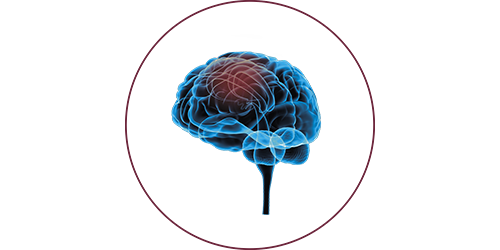 FES nach Schlaganfall | STIWELL® Neurorehabilitation