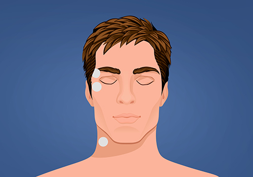 STIWELL Therapie | Aktivierung Lidschluss (EMG) STIWELL Therapie | Aktivierung Lidschluss (EMG)