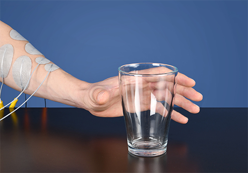 STIWELL Therapie | Greifen, Loslassen unilateral STIWELL Therapie | Greifen, Loslassen unilateral