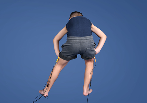STIWELL Therapie | Koordinationstraining Beine (Zerebralparese, ICP) STIWELL Therapie | Koordinationstraining Beine (Zerebralparese, ICP)