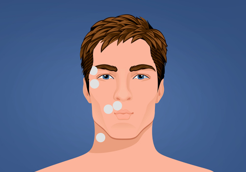 STIWELL Therapie | Lippen spitzen - Augen entspannt (EMG) STIWELL Therapie | Lippen spitzen - Augen entspannt (EMG)