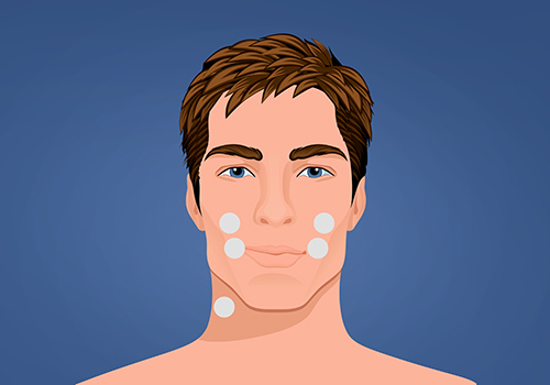 STIWELL Therapie | Mimisches Koordinationstraining (EMG) STIWELL Therapie | Mimisches Koordinationstraining (EMG)