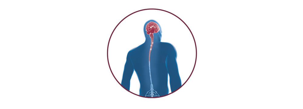 STIWELL® | functional electrical stimulation (FES)  for multiple sclerosis