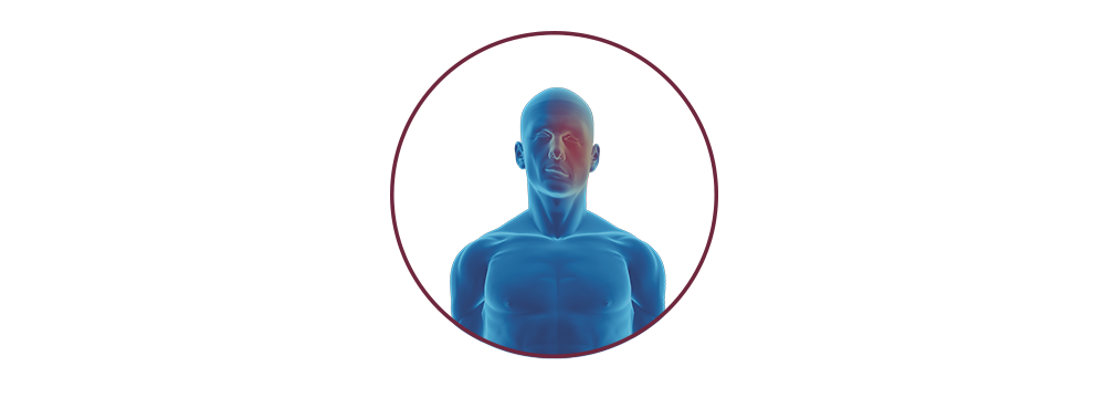 STIWELL® | Funktionelle Elektrostimulation (FES) bei Fazialisparese