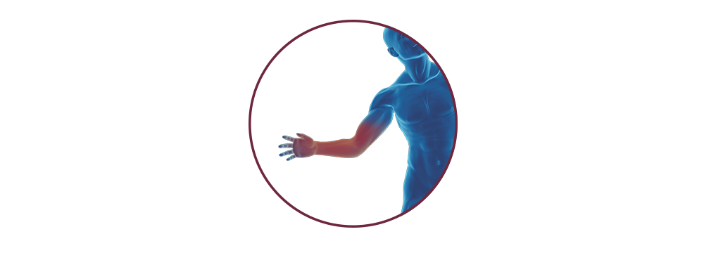 STIWELL® | Funktionelle Elektrostimulation (FES) bei Handverletzung