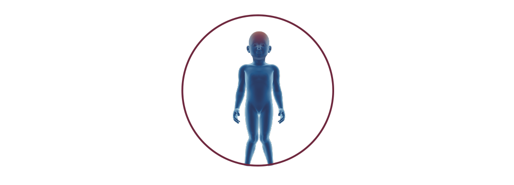 STIWELL® | Funktionelle Elektrostimulation (FES) bei Zerebralparese