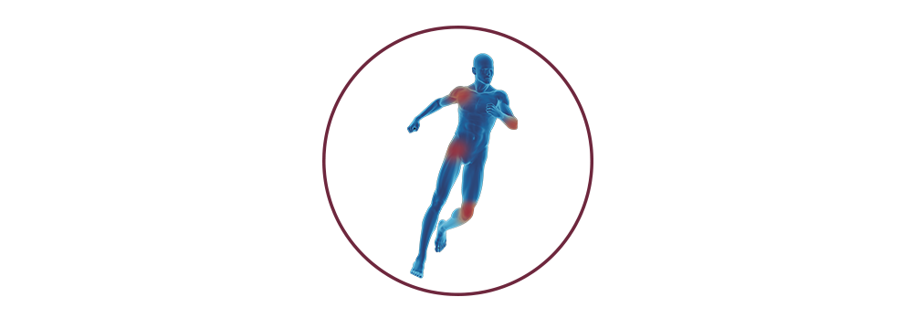 STIWELL® | Funktionelle Elektrostimulation (FES) in der Orthopädie