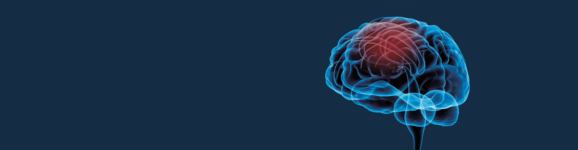 STIWELL® Neurorehabilitation | Anwendungen in der Neurologie